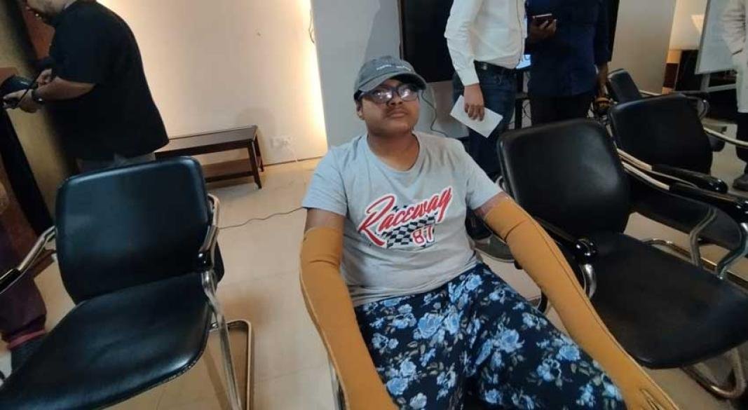 ৩৬ বার অপারেশন, ৯৭ দিন পর ঘরে ফিরল মাইলস্টোনের সেই শিক্ষার্থী